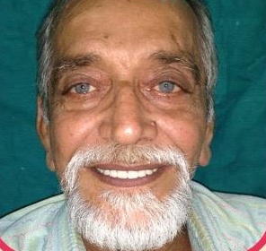 After, with the new dentures fitted, Complete Dentures at Smile 4U Family Dental Clinic, Kurla