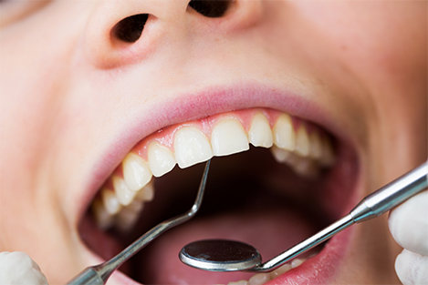 Regular Oral Checkups at Smile 4U Family Dental Clinic, Kurla, Mumbai