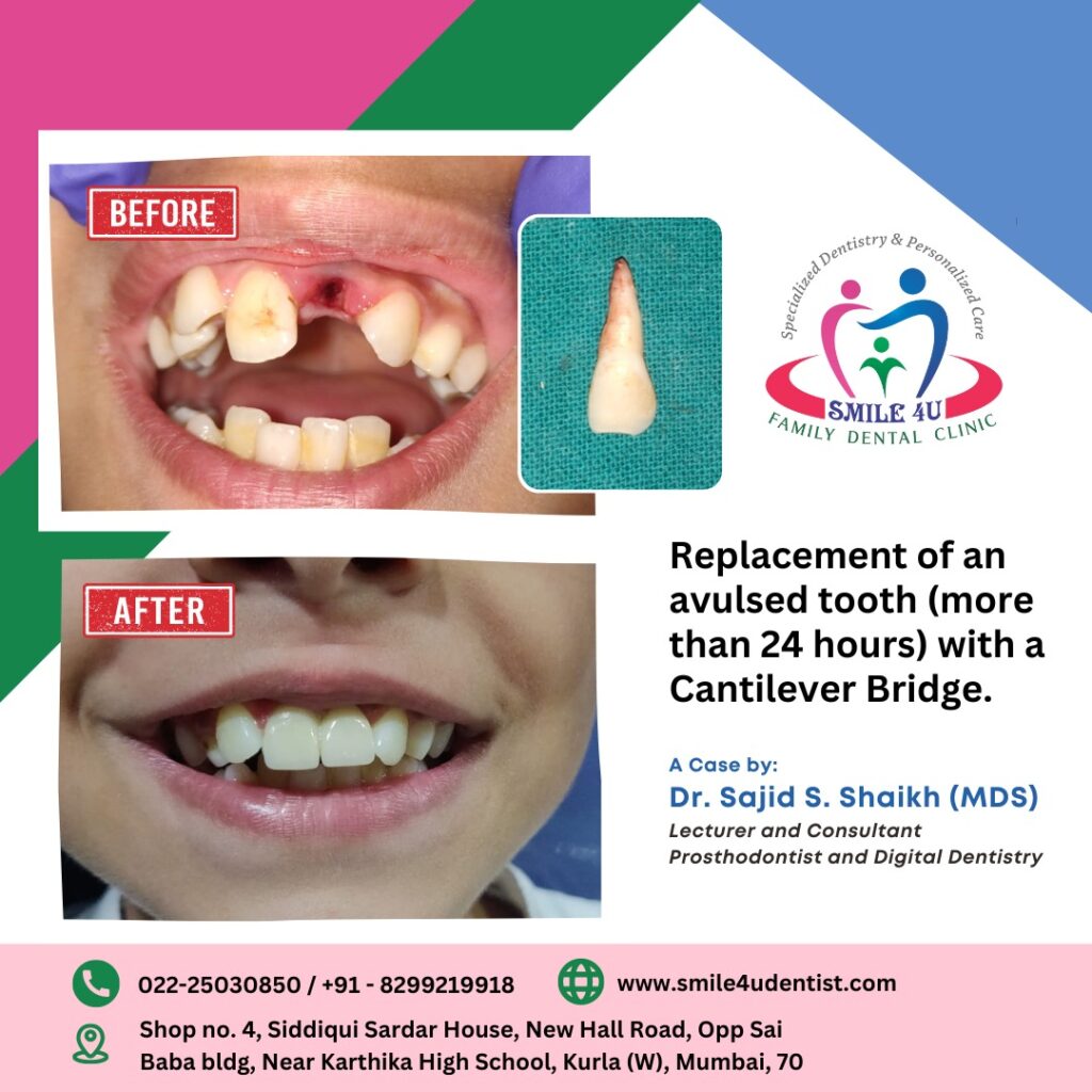 Child dentist in Mumbai