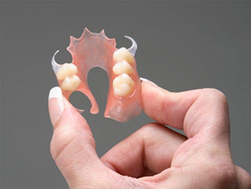 Dental implants in Mumbai